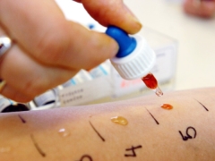 Skin tests for allergens in children