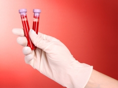 Serological blood test for hepatitis, HIV, syphilis and other diseases