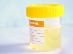 Urine analysis in children according to Zimnitsky