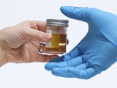 Urine analysis in children