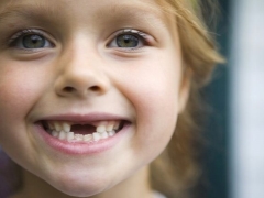 ¿Qué dientes tienen los niños?