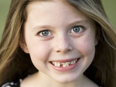 Curved teeth in children