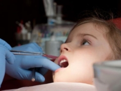 Treatment of pulpitis in milk teeth in children