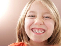 Plates for the alignment of teeth in children