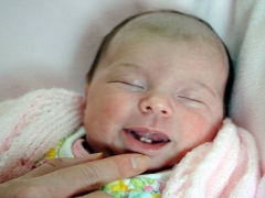 Baby born with teeth