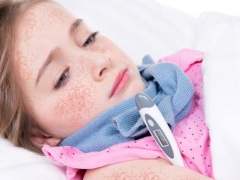 Scarlet fever in children: symptoms and treatment (17 photos)