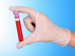 WBC blood test in children