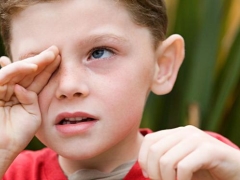 Bacterial conjunctivitis in children