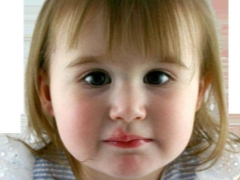 Herpes type 6 in children