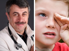 Dr. Komarovsky en conjuntivitis