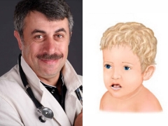 Dr. Komarovsky sobre el tratamiento de la candidiasis bucal en niños.