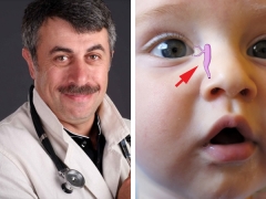 Dr. Komarovsky on the massage of the lacrimal canal in newborns