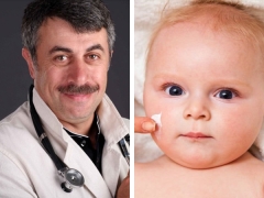 Dr. Komarovsky on the causes of dry skin in a child