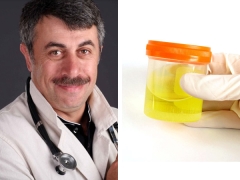 Dr. Komarovsky su analisi delle urine anormali in un bambino