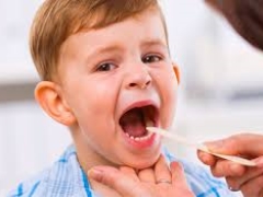 What does the throat of a child with pharyngitis look like?