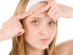 Treatment of teenage acne in girls