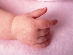 Marble skin in infants and newborns: causes, symptoms, and treatment