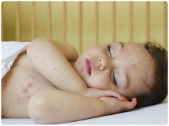 What do the spots on the skin of a child show?