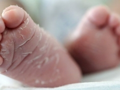 Perché un bambino ha la pelle secca e cosa fare?