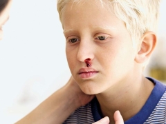 Thrombocytopenic purpura in children