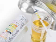 Nechiporenko urine analysis during pregnancy