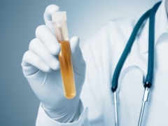 Erythrocytes in the urine during pregnancy and the causes of blood in the urine