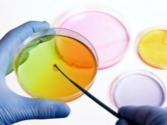 How to pass and decipher the bacteriological urine culture during pregnancy?