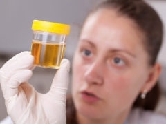 Terms of delivery of urine analysis during pregnancy