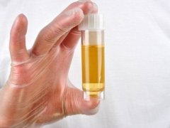 Causes and effects of elevated levels of sugar in the urine during pregnancy