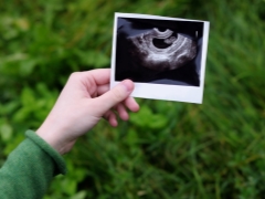 Ultrasound at 4 weeks gestation