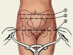 ¿Cómo medir el tamaño de la pelvis durante el embarazo y qué normas existen?