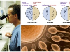 ¿Cómo mejorar la morfología de los espermatozoides y qué fármacos elegir?