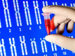 Co to jest nieinwazyjny test DNA prenatalnego i dlaczego wykonuje się go w czasie ciąży?