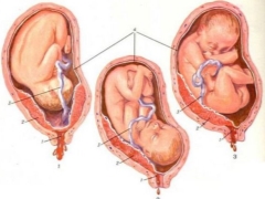 What is the presentation of the fetus and what does it affect?