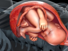 Tipos de unión del cordón umbilical a la placenta: normas y riesgo de desviaciones