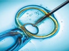 What is ICSI - intracytoplasmic sperm injection, how is the procedure?