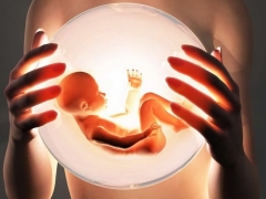 Assisted Reproductive Technologies