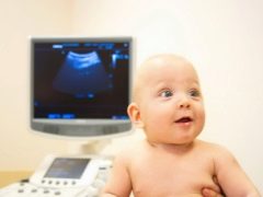 Ultrasound of the brain in newborns and infants