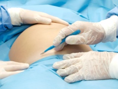 How many times can a cesarean section be done?