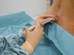 Spinale anesthesie voor keizersnede