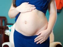 How many months can you have a baby after cesarean section?