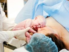 How long is the cesarean section and how does the duration of the operation depend?