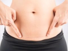 Features of pregnancy a year after cesarean section