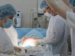 Paghahanda para sa cesarean section