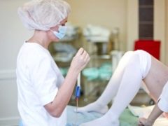 How long should I wear compression stockings after cesarean section?