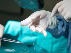 Caratteristiche di guarigione delle suture dopo l'episiotomia e risoluzione dei possibili problemi