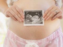 Parto a 32 settimane di gestazione