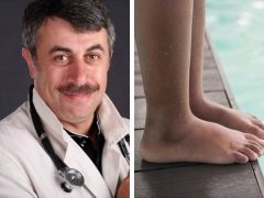 Dr. Komarovsky about flat feet in children