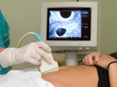 When does the fetus's heart begin to beat? When can you hear a heartbeat or see it on an ultrasound?