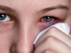 Psychosomatic sanhi ng conjunctivitis sa mga bata at matatanda